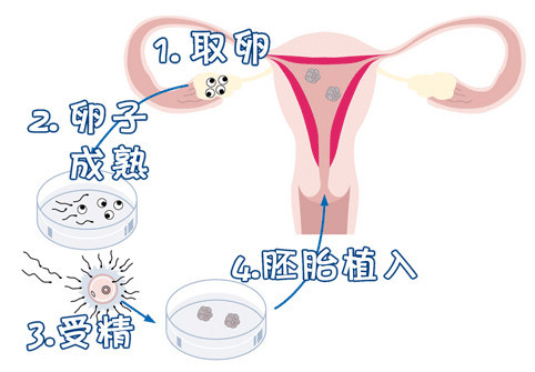 好孕案例